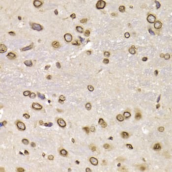 LAMB2 / Laminin Beta 2 Antibody