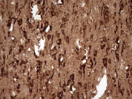 FARSB Antibody (clone OTI4B3)