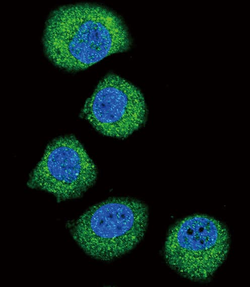 FGFR2 / FGF Receptor 2 Antibody