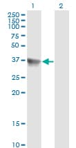 IHC-plus™ SH3GLB1 / Bif / Endophilin B1 Antibody (clone 1B3-A5)