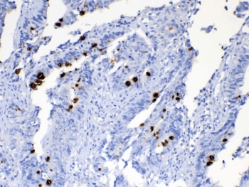 Polyclonal Rabbit anti-Human Mucin 2 / MUC2 Antibody (IHC)