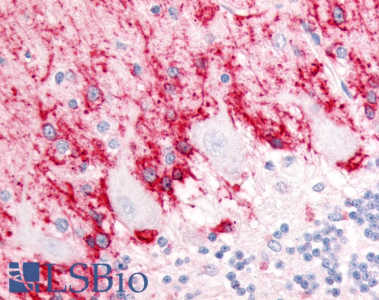 PathPlus™ Polyclonal Rabbit anti-Human SLC1A3 / EAAT1 Antibody (Cytoplasmic Domain, IHC)