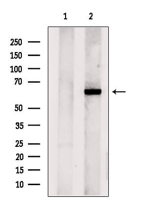 Polyclonal Rabbit anti-Human CPNE6 / N-COPINE Antibody (IF, WB)