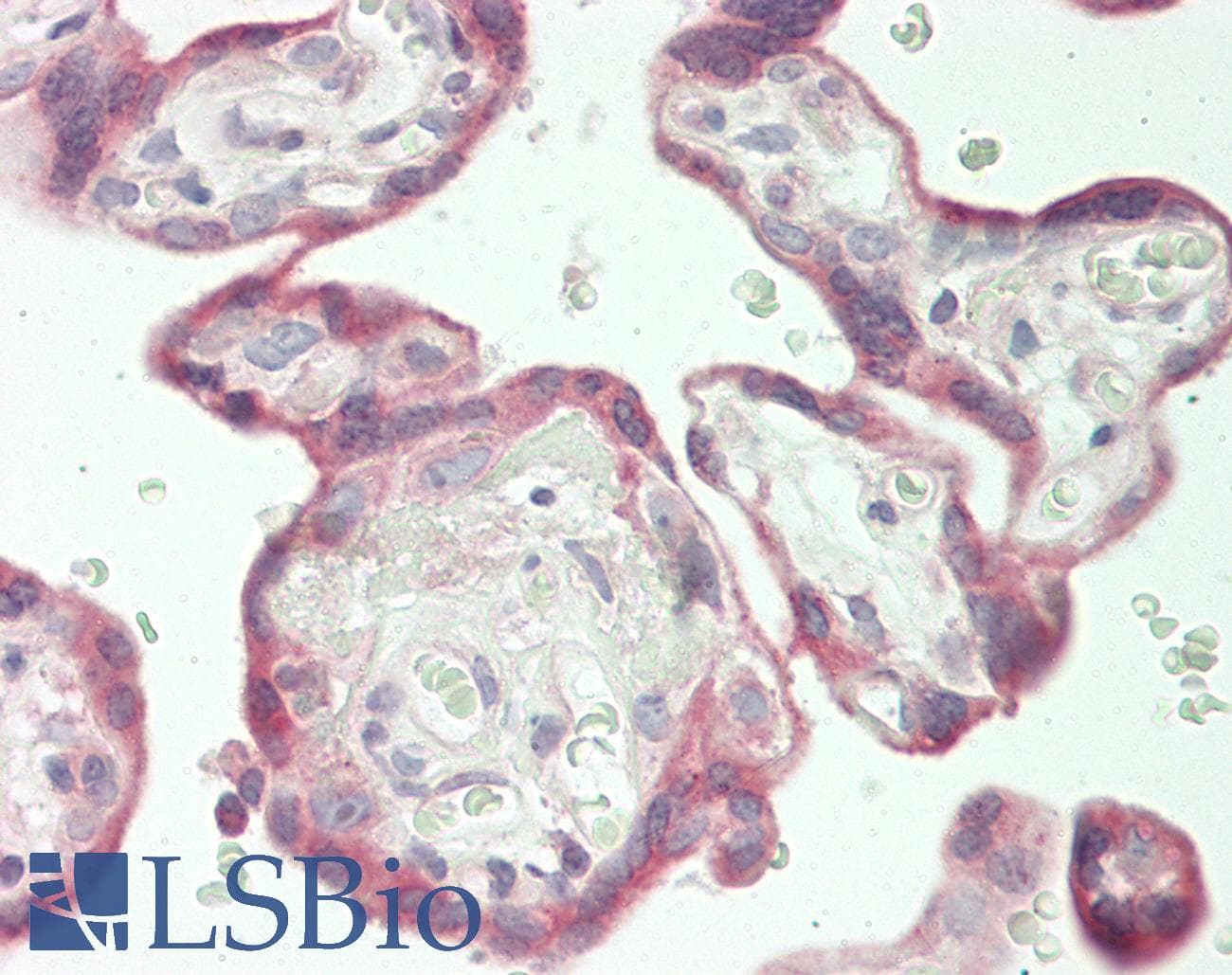 PathPlus™ TGFBR2 Antibody (aa13-40)