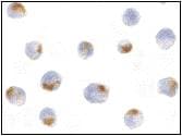 PathPlus™ Polyclonal Rabbit anti-Human ACIN1 / Acinus Antibody (IHC, IF, WB)