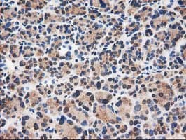 CAT / Catalase Antibody (clone OTI1B8)