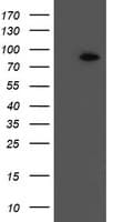 F13A1 / Factor XIIIa Antibody (clone OTI1E9)