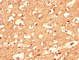 CPLX1 / Complexin 1 Antibody