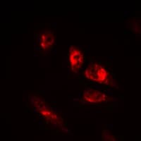 Polyclonal Rabbit anti-Human POU2F2 / OCT2 Antibody (N-Terminus, IHC, IF, WB)
