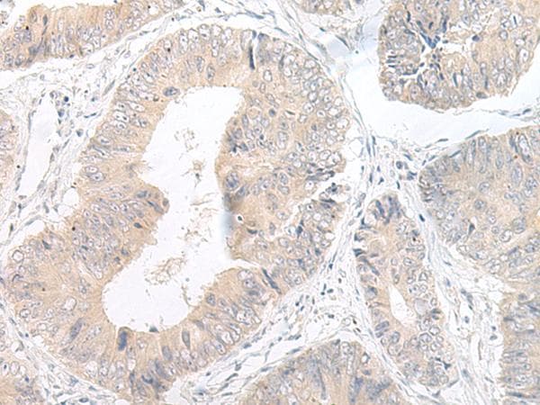 Polyclonal Rabbit anti-Human LYRM2 Antibody (IHC)