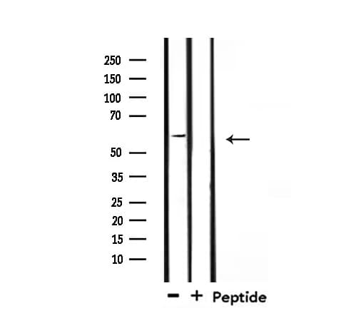 TGFBR2 Antibody
