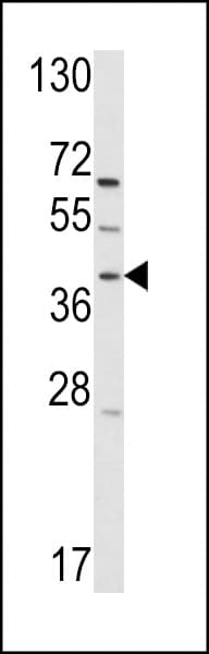 GPRC5A / RAI3 Antibody (aa328-357)