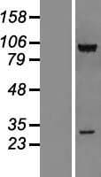 CSRP2BP Protein (Over-Expression Lysate Myc-DDK (Flag))
