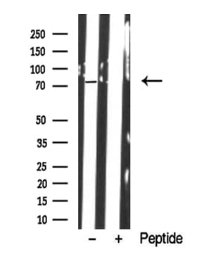Polyclonal Rabbit anti-Human KIZ / PLK1S1 Antibody (WB)