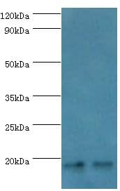 Polyclonal Rabbit anti-Human NCBP2 / CBP20 Antibody (aa1-156, IHC, WB)