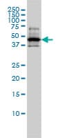 IHC-plus™ Monoclonal Mouse anti-Human RCC1 Antibody (clone 2F1, IHC, IF, WB)