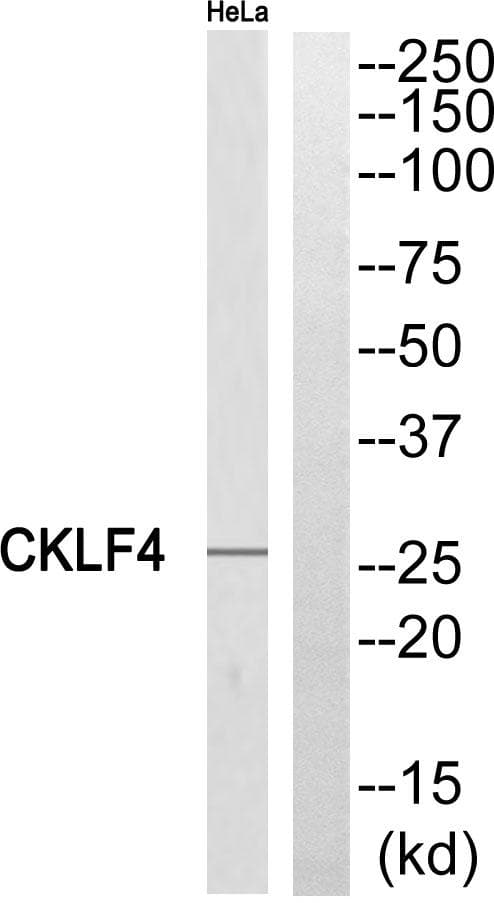 CKLFSF4 / CMTM4 Antibody