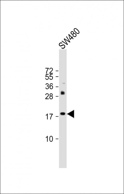 KISS1 / Kisspeptin / Metastin Antibody (aa20-52)