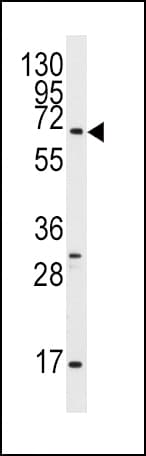 Polyclonal Rabbit anti-Human PAEL Receptor / GPR37 Antibody (aa217-246, IHC, WB)