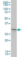 Monoclonal Mouse anti-Human LFNG / Lunatic Fringe Antibody (clone 2D10-3C11, IF, WB)