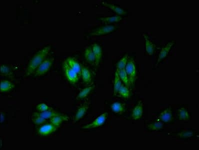 Polyclonal Rabbit anti-Human DMN / Desmuslin / Synemin Antibody (aa1147-1417, IHC, IF)