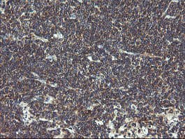 Monoclonal Mouse anti-Human VBP1 Antibody (clone OTI2C2, IHC, WB)