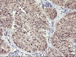 MAP2K3 / MEK3 / MKK3 Antibody (clone OTI5D7)