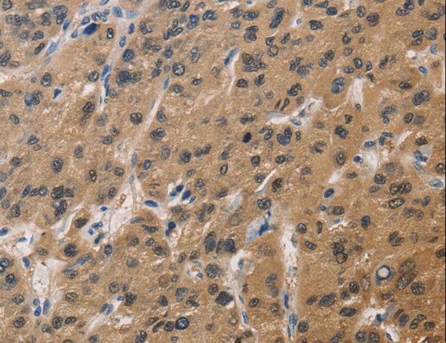 DUSP26 / MKP8 Antibody