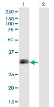 IGFBP1 Antibody (clone 2F9)
