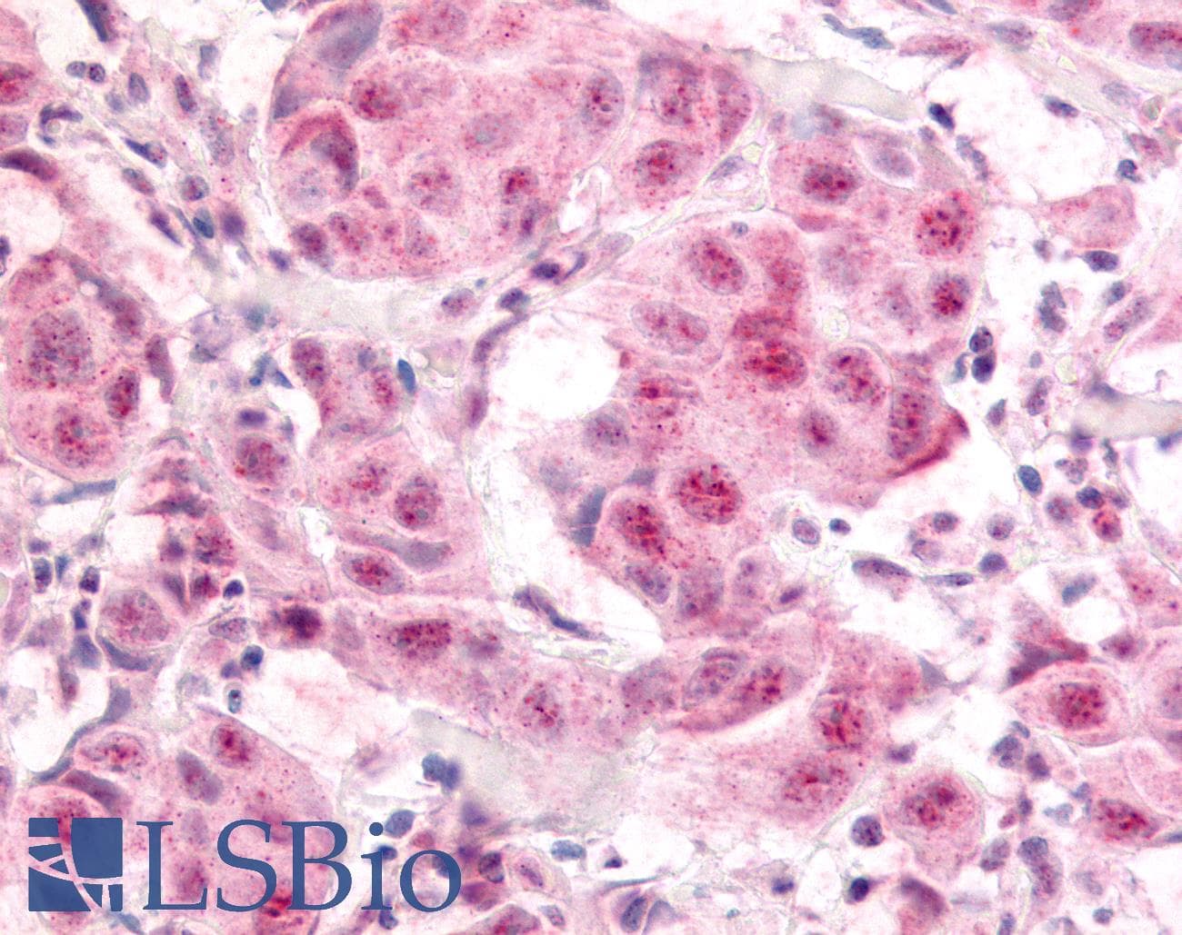 IHC-plus™ E2F1 Antibody (phospho-Ser364)