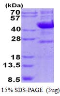 Human NEU1 / NEU Protein (Recombinant His)