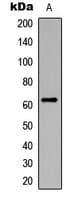 CHEK2 / CHK2 Antibody (phospho-Ser516)