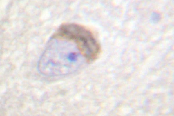 PPP1R1B / DARPP-32 Antibody (Pro69)