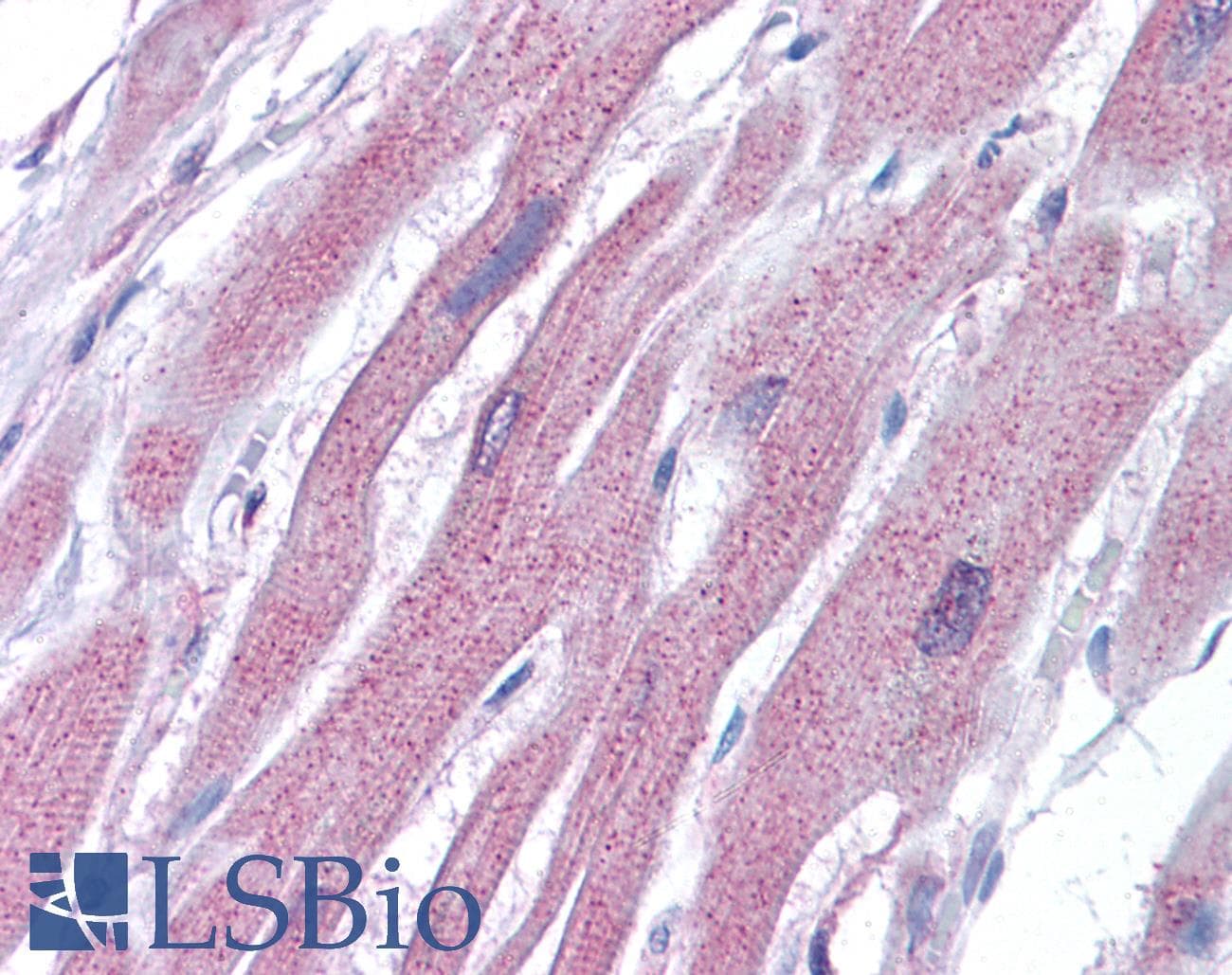 IHC-plus™ Polyclonal Rabbit anti-Human ACTR2 / ARP2 Antibody (IHC, WB)