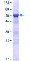 Human IFT46 Protein (Recombinant GST)