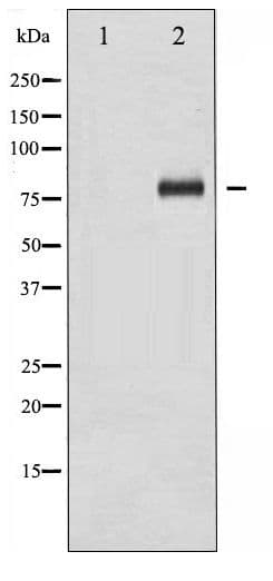 FOXO1 / FKHR Antibody (phospho-Ser329)