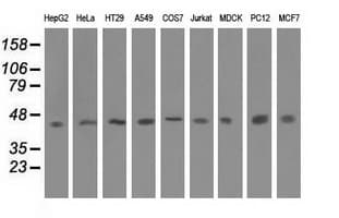 IVD Antibody (clone OTI5A11)