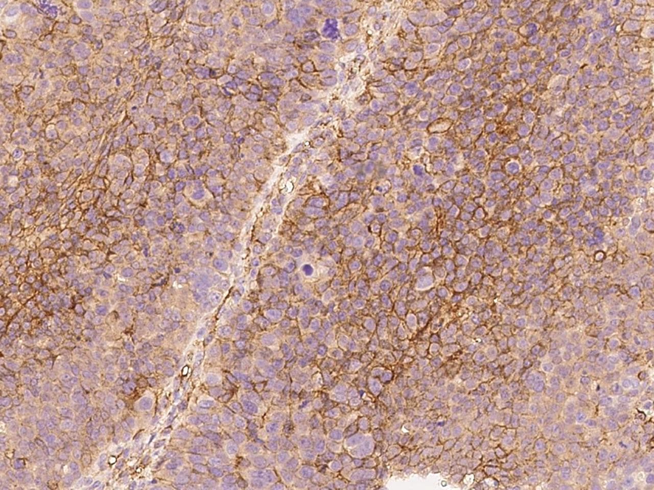 CD276 / B7-H3 Antibody (Preservative Free)