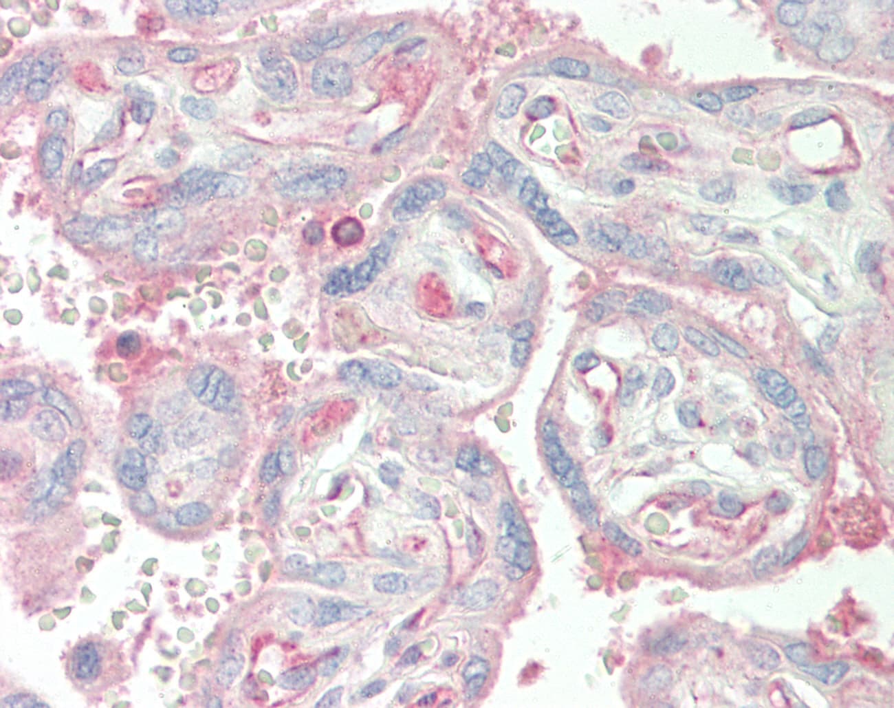 Polyclonal Rabbit anti-Human ESRRG / ERR Gamma Antibody (aa71-120, IHC, WB)