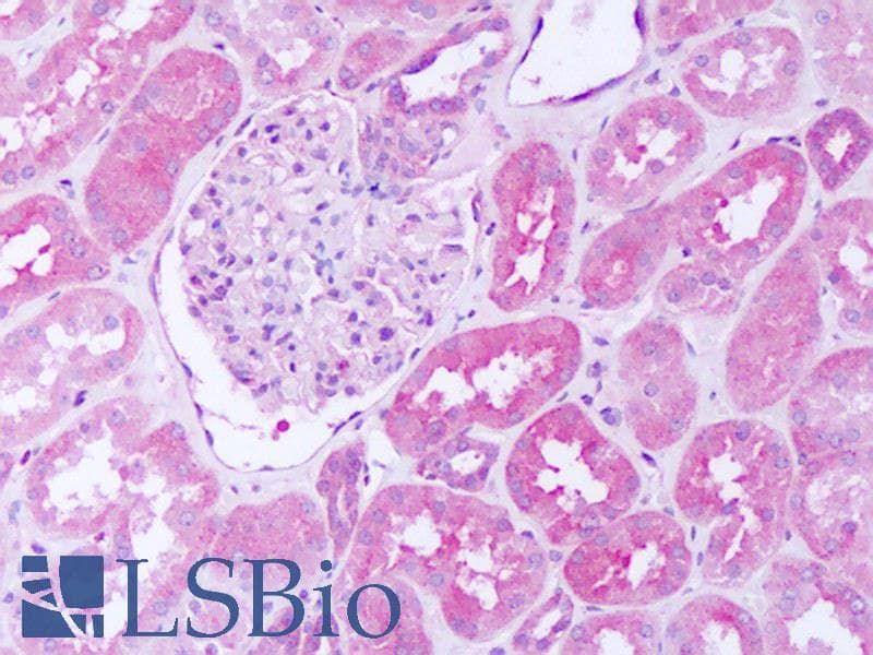 Polyclonal Rabbit anti-Human SH2D4A Antibody (aa145-194, IHC, WB)