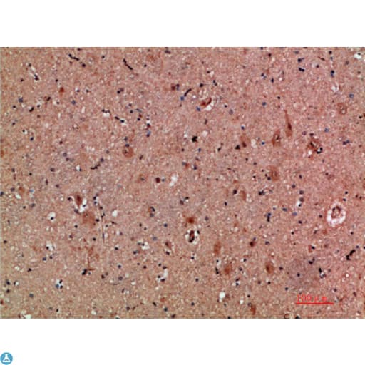 Polyclonal Rabbit anti-Human CLCF1 Antibody (IHC)