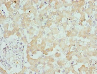 DCXR Antibody