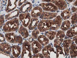 Monoclonal Mouse anti-Human MYD88 Antibody (clone OTI2B2, IHC, IF, WB)