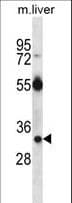 Polyclonal Rabbit anti-Human Dexras1 / RASD1 Antibody (aa248-277, IHC, WB)