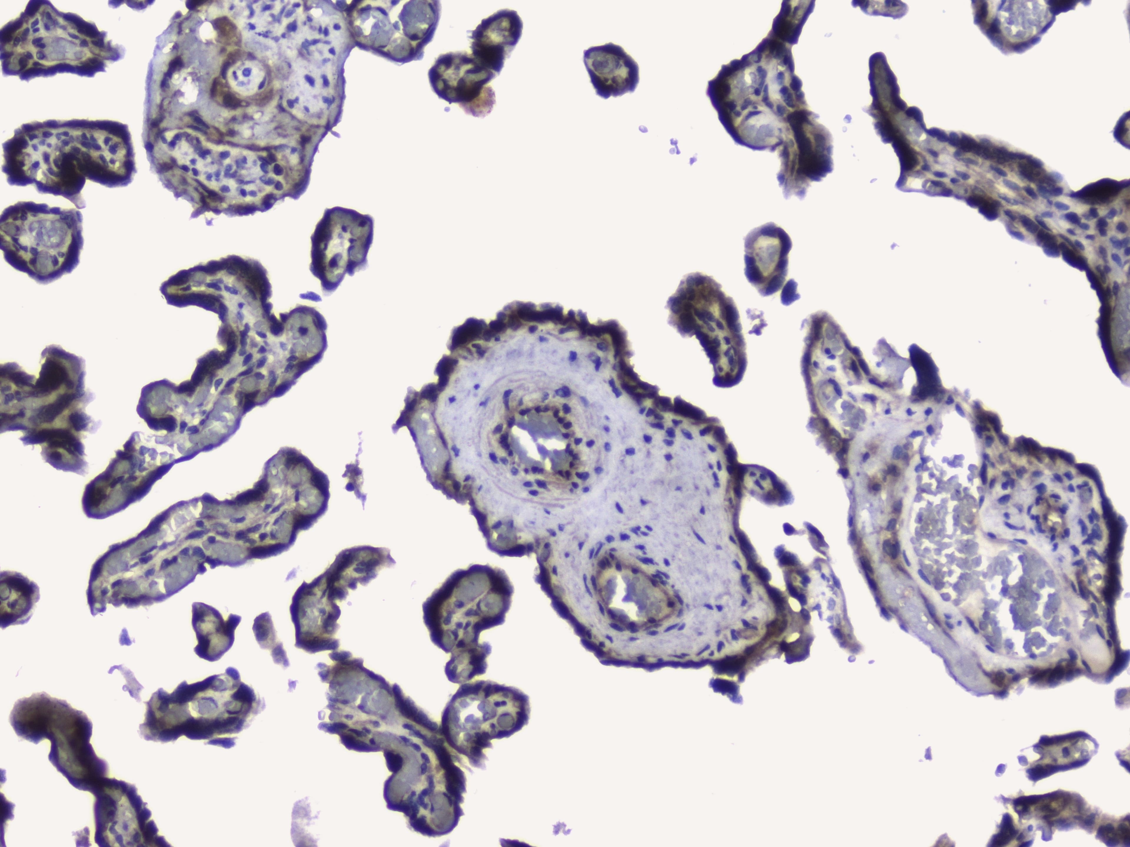 Polyclonal Rabbit anti-Human RIP1 / RALBP1 Antibody (IHC, WB)