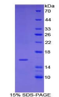Mouse IGF1 Protein (Recombinant His-T7)