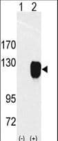 ROR1 Antibody (aa32-62)