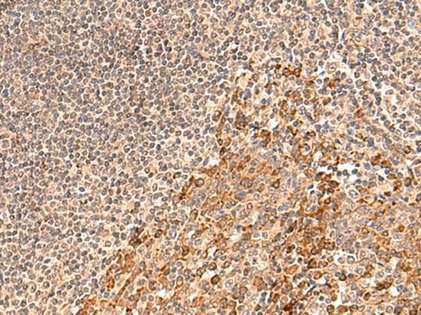 GALNT12 Antibody