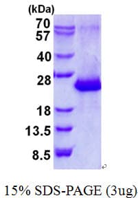 Human AMTN Protein (Recombinant His)