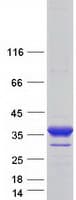 Human BCAP31 / BAP31 Protein (Recombinant Myc-DDK (Flag))